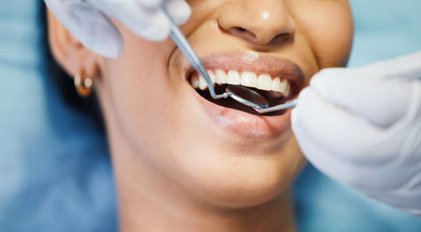 Trusted Parole, MD  Dental Services Experts